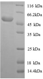 Recombinant Mouse Acyl-protein thioesterase 1 (Lypla1) – Figure 1 of 1