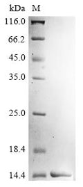 (Tris-Glycine gel) Discontinuous SDS-PAGE (reduced) with 5% enrichment gel and 15% separation gel.