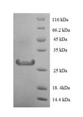 Recombinant Human Lysozyme C (LYZ) – Figure 1 of 1