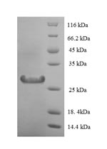 Recombinant Human Lysozyme C (LYZ) – Figure 1 of 1