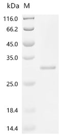 (Tris-Glycine gel) Discontinuous SDS-PAGE (reduced) with 5% enrichment gel and 15% separation gel.