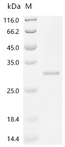 (Tris-Glycine gel) Discontinuous SDS-PAGE (reduced) with 5% enrichment gel and 15% separation gel.