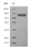 Recombinant Human Amine oxidase [flavin-containing] B (MAOB), partial – Figure 1 of 1
