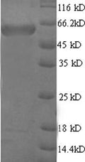 Recombinant Mouse Microtubule-associated protein 2 (Map2), partial – Figure 1 of 1