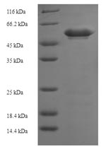 Recombinant Human Dual specificity mitogen-activated protein kinase kinase 3 (MAP2K3) – Figure 1 of 1