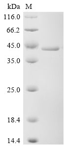 (Tris-Glycine gel) Discontinuous SDS-PAGE (reduced) with 5% enrichment gel and 15% separation gel.