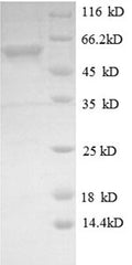 Recombinant Mouse Dual specificity mitogen-activated protein kinase kinase 4 (Map2k4) – Figure 1 of 1