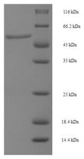 Recombinant Human Dual specificity mitogen-activated protein kinase kinase 6 (MAP2K6) – Figure 1 of 1