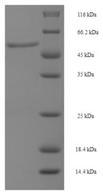 Recombinant Human Dual specificity mitogen-activated protein kinase kinase 6 (MAP2K6) – Figure 1 of 1