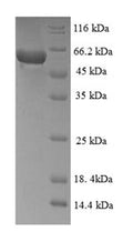 Recombinant Human Mitogen-activated protein kinase 13 (MAPK13) – Figure 1 of 1