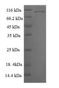 Recombinant Human Mitogen-activated protein kinase 6 (MAPK6) – Figure 1 of 1
