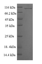 Recombinant Human Mitogen-activated protein kinase 6 (MAPK6) – Figure 1 of 1
