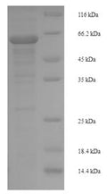 Recombinant Human Mitogen-activated protein kinase 9 (MAPK9) – Figure 1 of 1