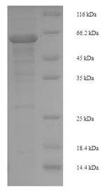 Recombinant Human Mitogen-activated protein kinase 9 (MAPK9) – Figure 1 of 1