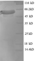 Recombinant Macaca mulatta Microtubule-associated protein tau (MAPT) – Figure 1 of 1