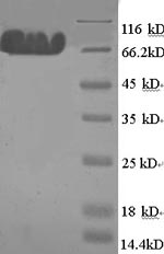 Recombinant Rat Microtubule-associated protein tau (Mapt) – Figure 1 of 1