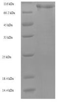 Recombinant Human Mannan-binding lectin serine protease 1 (MASP1) – Figure 1 of 1