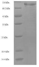 Recombinant Human Mannan-binding lectin serine protease 1 (MASP1) – Figure 1 of 1