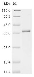 (Tris-Glycine gel) Discontinuous SDS-PAGE (reduced) with 5% enrichment gel and 15% separation gel.