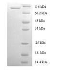 Recombinant Human DNA replication licensing factor MCM2 (MCM2) – Figure 1 of 1