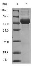 (Tris-Glycine gel) Discontinuous SDS-PAGE (reduced) with 5% enrichment gel and 15% separation gel.