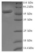 Recombinant Human Malate dehydrogenase, mitochondrial (MDH2) – Figure 1 of 1