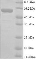 Recombinant Mouse E3 ubiquitin-protein ligase Mdm2 (Mdm2) – Figure 1 of 1