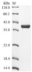 (Tris-Glycine gel) Discontinuous SDS-PAGE (reduced) with 5% enrichment gel and 15% separation gel.