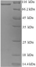 Recombinant Rabbit Melanotransferrin (Mfi2), partial – Figure 1 of 1