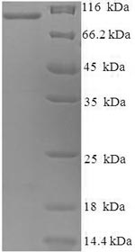 Recombinant Rabbit Melanotransferrin (Mfi2), partial – Figure 1 of 1