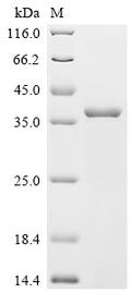(Tris-Glycine gel) Discontinuous SDS-PAGE (reduced) with 5% enrichment gel and 15% separation gel.