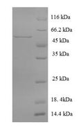 Recombinant Rat Multiple inositol polyphosphate phosphatase 1 (Minpp1) – Figure 1 of 1