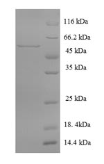Recombinant Rat Multiple inositol polyphosphate phosphatase 1 (Minpp1) – Figure 1 of 1
