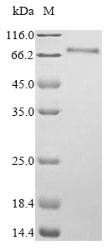 Recombinant Human Proliferation marker protein Ki-67 (MKI67), partial – Figure 1 of 1