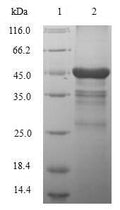 (Tris-Glycine gel) Discontinuous SDS-PAGE (reduced) with 5% enrichment gel and 15% separation gel.