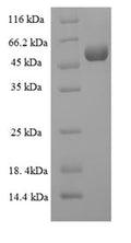 Recombinant Human Collagenase 3 (MMP13) – Figure 1 of 1