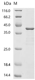 (Tris-Glycine gel) Discontinuous SDS-PAGE (reduced) with 5% enrichment gel and 15% separation gel.