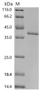 (Tris-Glycine gel) Discontinuous SDS-PAGE (reduced) with 5% enrichment gel and 15% separation gel.