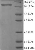 Recombinant Rat 72KDA type IV collagenase (Mmp2) – Figure 1 of 1