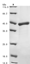 (Tris-Glycine gel) Discontinuous SDS-PAGE (reduced) with 5% enrichment gel and 15% separation gel.