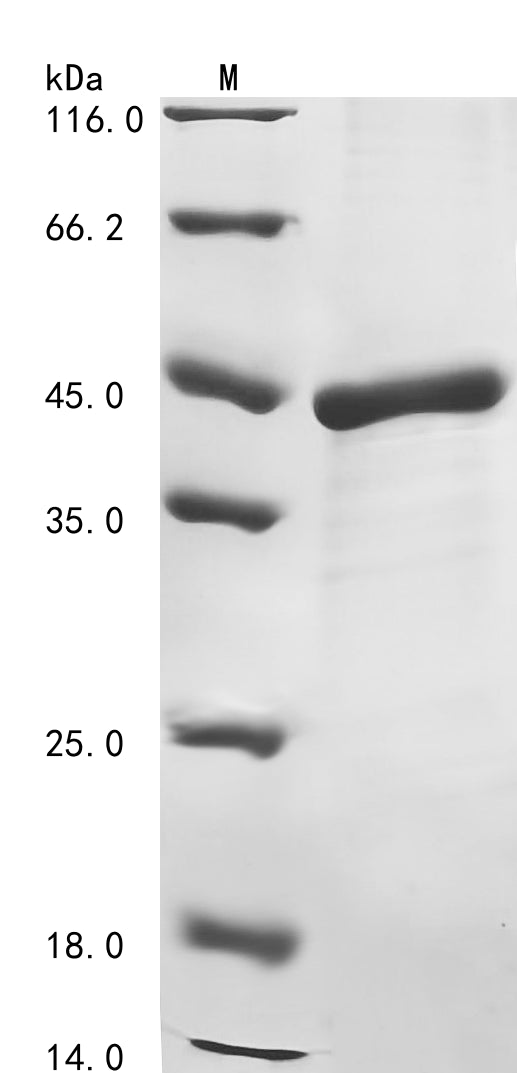 (Tris-Glycine gel) Discontinuous SDS-PAGE (reduced) with 5% enrichment gel and 15% separation gel.