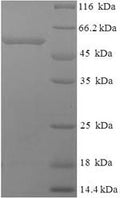 Recombinant Human Thrombopoietin receptor (MPL), partial – Figure 1 of 1