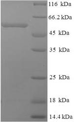 Recombinant Human Thrombopoietin receptor (MPL), partial – Figure 1 of 1