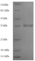Recombinant Human Protein Mpv17 (MPV17) – Figure 1 of 1