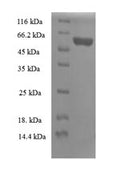 Recombinant Human 39S ribosomal protein L19, mitochondrial (MRPL19) – Figure 1 of 1