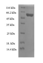 Recombinant Human 39S ribosomal protein L19, mitochondrial (MRPL19) – Figure 1 of 1