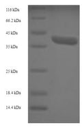 Recombinant Human 39S ribosomal protein L42, mitochondrial (MRPL42) – Figure 1 of 1
