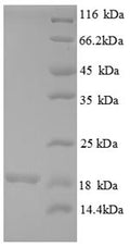 Recombinant Human 39S ribosomal protein L54, mitochondrial (MRPL54) – Figure 1 of 1