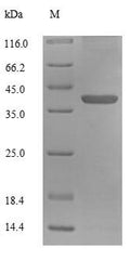 Recombinant Human 39S ribosomal protein L55, mitochondrial (MRPL55) – Figure 1 of 1