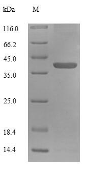 Recombinant Human 39S ribosomal protein L55, mitochondrial (MRPL55) – Figure 1 of 1